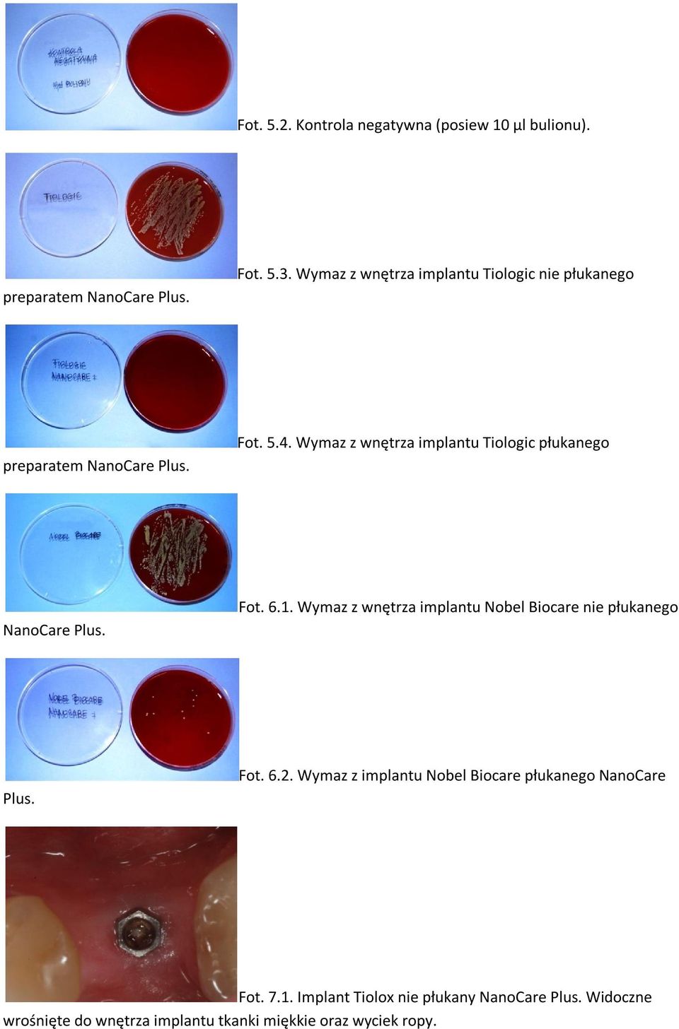 Wymaz z wnętrza implantu Tiologic płukanego NanoCare Plus. Fot. 6.1.