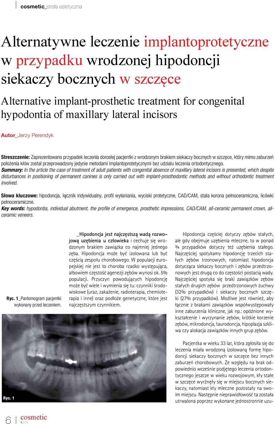 jedynie metodami implantoprotetycznymi bez udziału leczenia ortodontycznego.