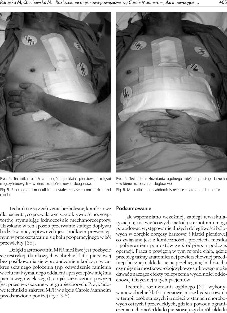 Technika rozluźniania ogólnego mięśnia prostego brzucha w kierunku bocznie i dogłowowo. Fig. 6.