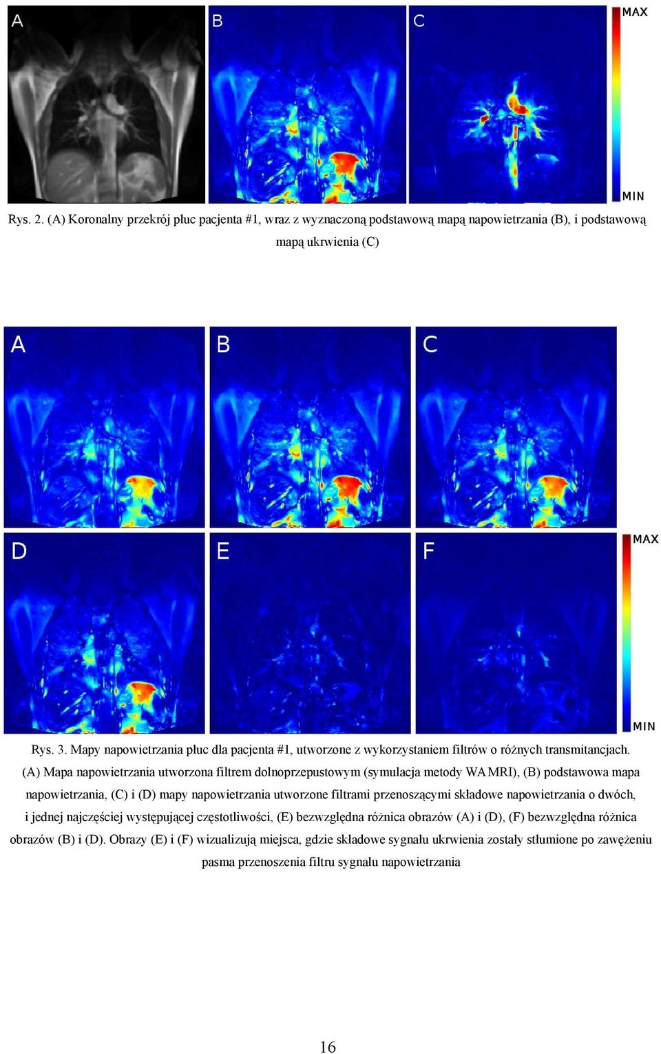(A) Mapa napowietrzania utworzona filtrem dolnoprzepustowym (symulacja metody WA MRI), (B) podstawowa mapa napowietrzania, (C) i (D) mapy napowietrzania utworzone filtrami przenoszącymi