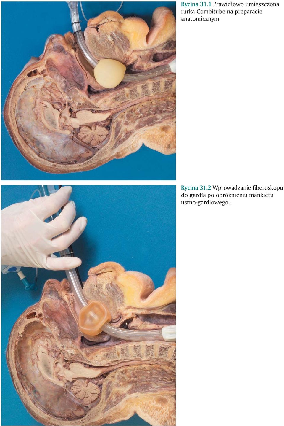 na preparacie anatomicznym.