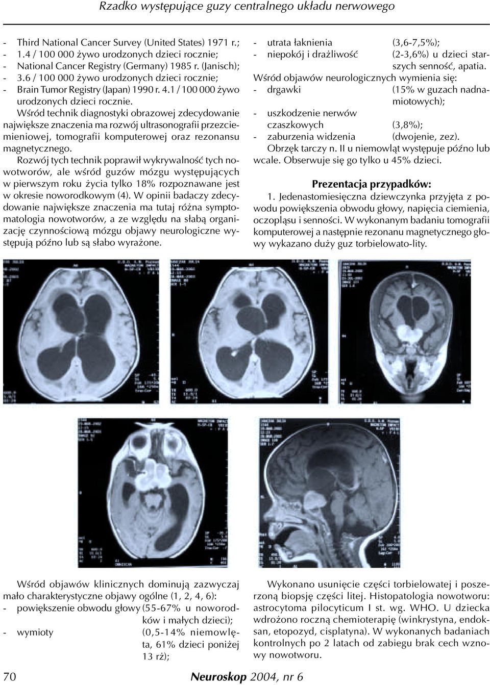 Wœród technik diagnostyki obrazowej zdecydowanie najwiêksze znaczenia ma rozwój ultrasonografii przezciemieniowej, tomografii komputerowej oraz rezonansu magnetycznego.