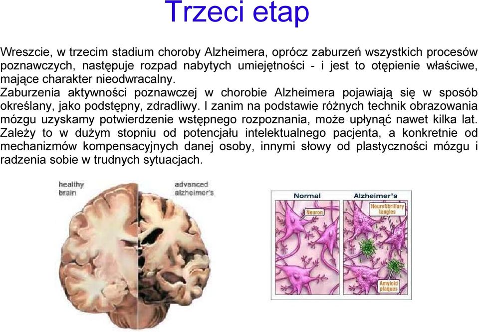 Zaburzenia aktywności poznawczej w chorobie Alzheimera pojawiają się w sposób określany, jako podstępny, zdradliwy.