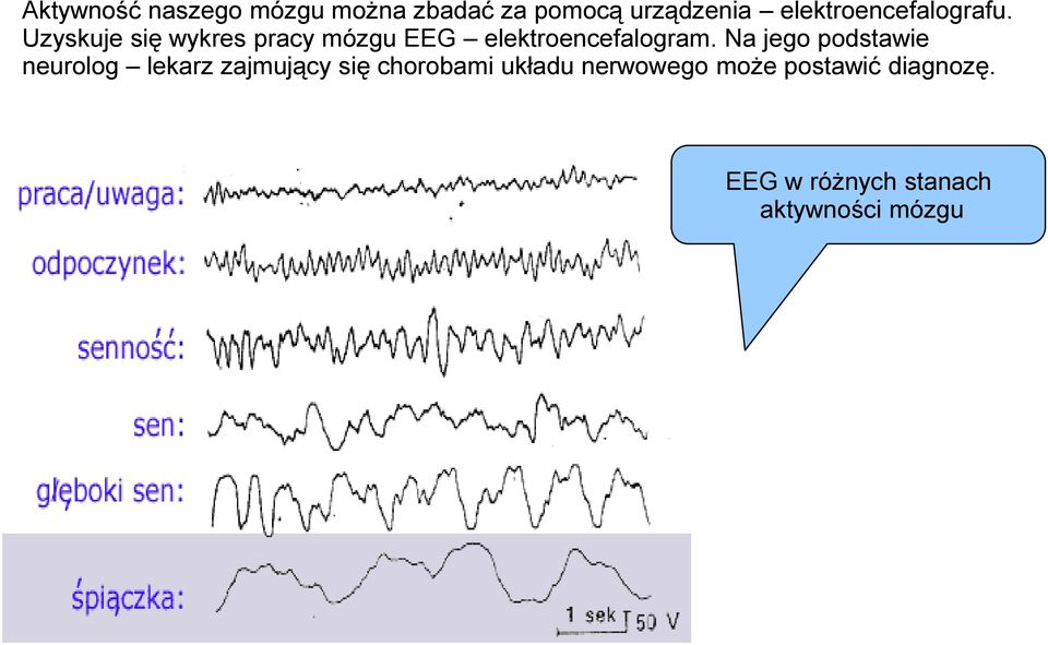 Uzyskuje się wykres pracy mózgu EEG elektroencefalogram.
