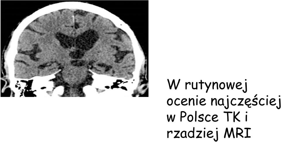 najczęściej w