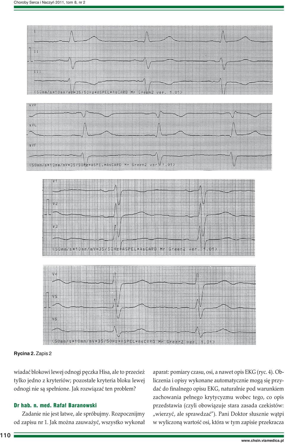 Rafał Baranowski Zadanie nie jest łatwe, ale spróbujmy. Rozpocznijmy od zapisu nr 1. Jak można zauważyć, wszystko wykonał aparat: pomiary czasu, osi, a nawet opis EKG (ryc. 4).