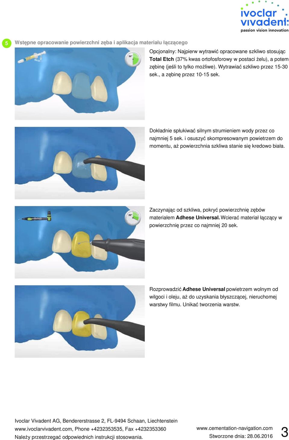 i osuszyć skompresowanym powietrzem do momentu, aż powierzchnia szkliwa stanie się kredowo biała. Zaczynając od szkliwa, pokryć powierzchnię zębów materiałem Adhese Universal.