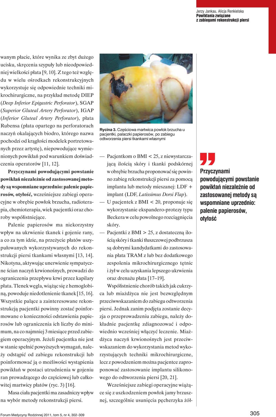 Artery Perforator), IGAP (Inferior Gluteal Artery Perforator), płata Rubensa (płata opartego na perforatorach naczyń okalających biodro, którego nazwa pochodzi od krągłości modelek portretowanych