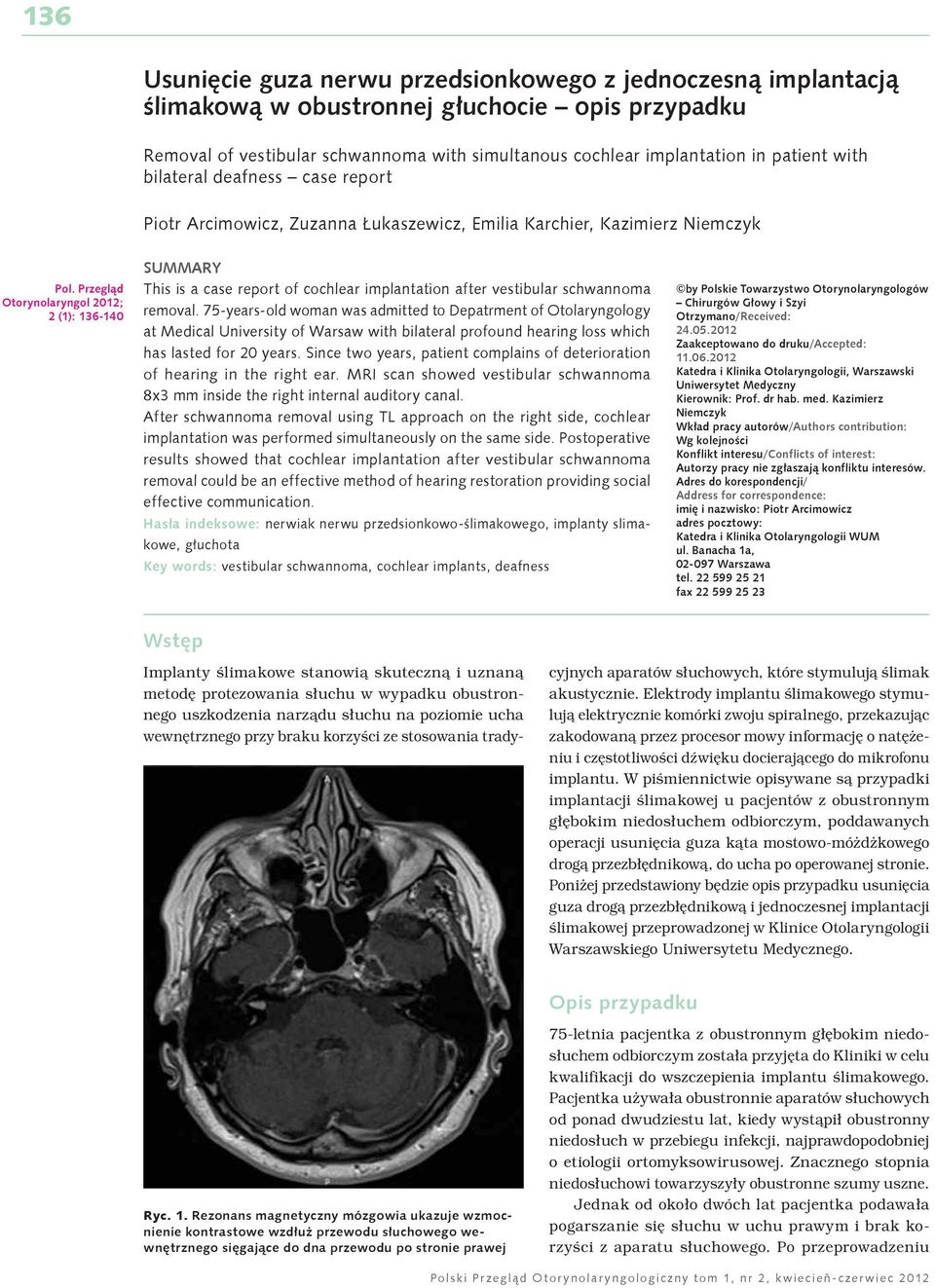 Przegląd Otorynolaryngol 2012; 2 (1): 136-140 SUMMARY This is a case report of cochlear implantation after vestibular schwannoma removal.
