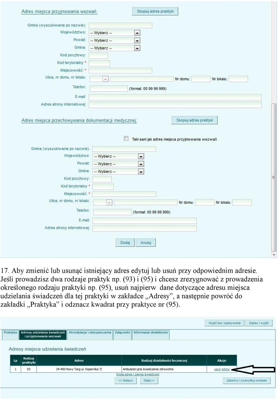 (93) i (95) i chcesz zrezygnować z prowadzenia określonego rodzaju praktyki np.