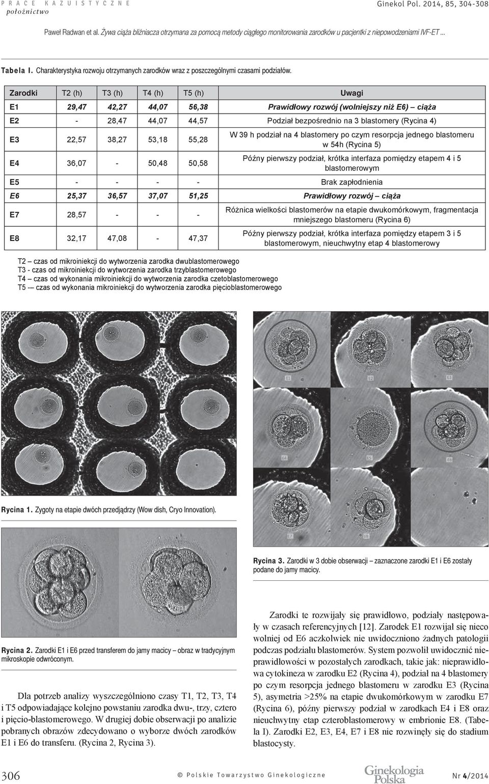 51,25 E7 28,57 - - - E8 32,17 47,08-47,37 T2 T3 - T4 T5 -, ( 6), 3 5, h 4 Rycina 1. Zygoty na etapie dwóch przedjądrzy (Wow dish, Cryo Innovation). Rycina 3.