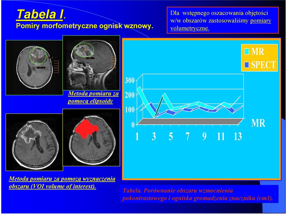 Metoda pomiaru za pomocą elipsoidy 300 200 100 0 1 3 5 7 9 11 13 MR SPECT MR Metoda pomiaru za
