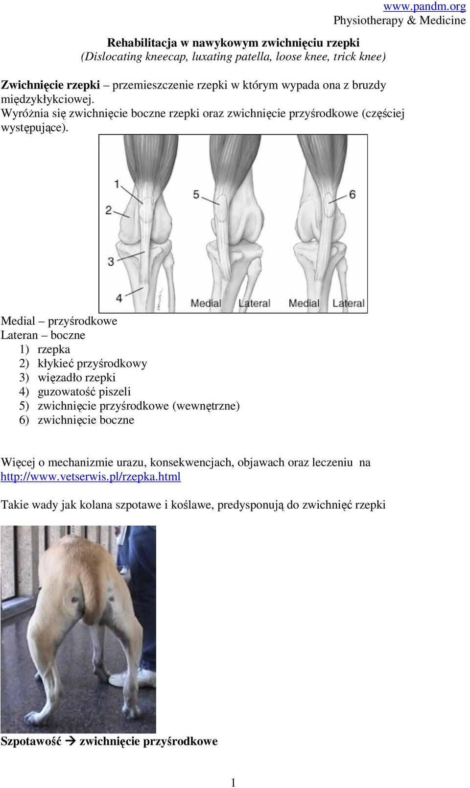 Wyróżnia się zwichnięcie boczne rzepki oraz zwichnięcie przyśrodkowe (częściej występujące).