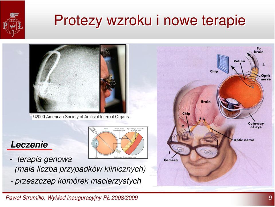klinicznych) - przeszczep komórek