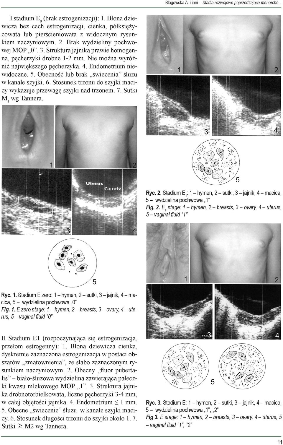 Struktura jajnika prawie homogenna, pęcherzyki drobne 1-2 mm. Nie można wyróżnić największego pęcherzyka. 4. Endometrium niewidoczne. 5. Obecność lub brak świecenia śluzu w kanale szyjki. 6.