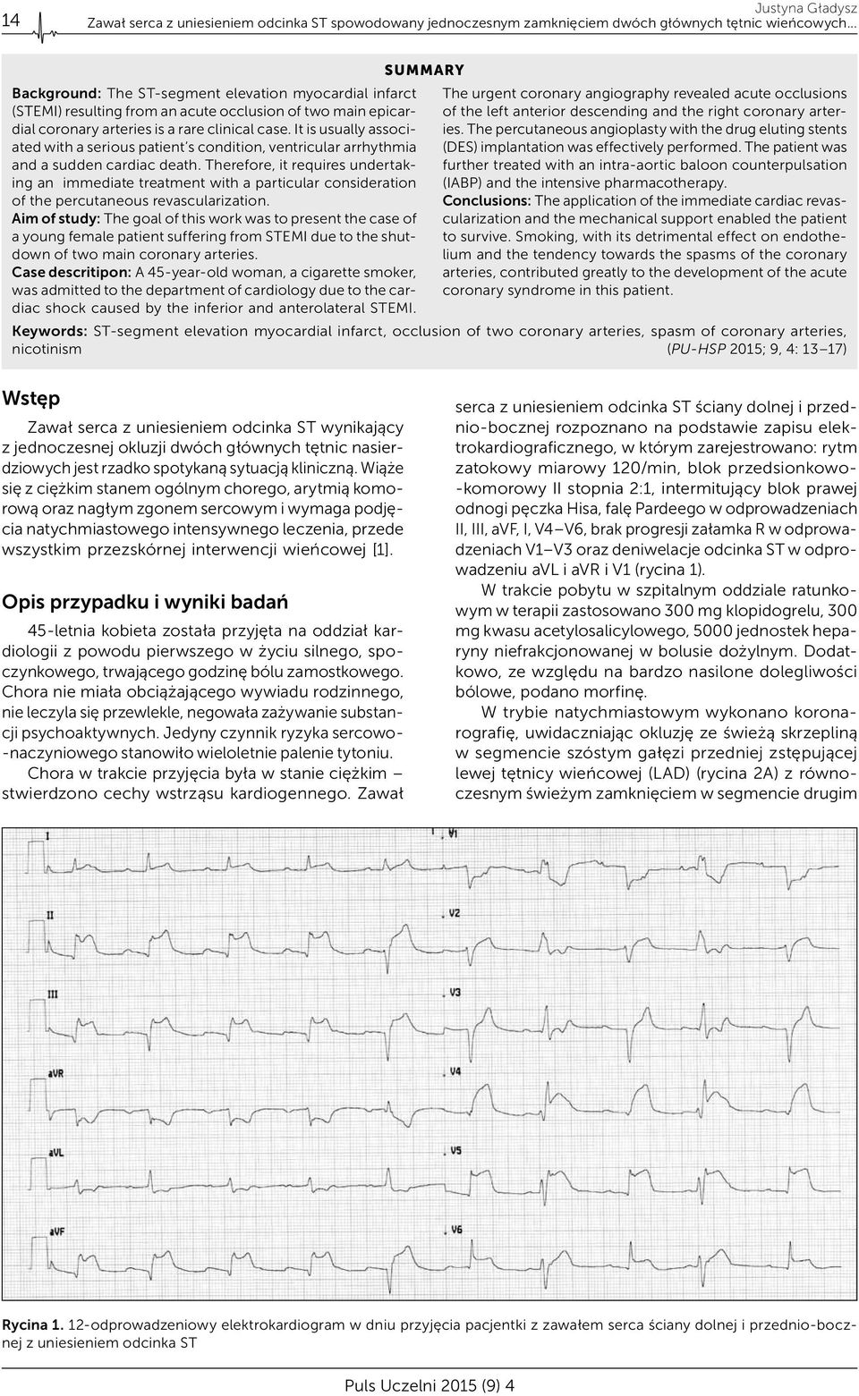 It is usually associated with a serious patient s condition, ventricular arrhythmia and a sudden cardiac death.