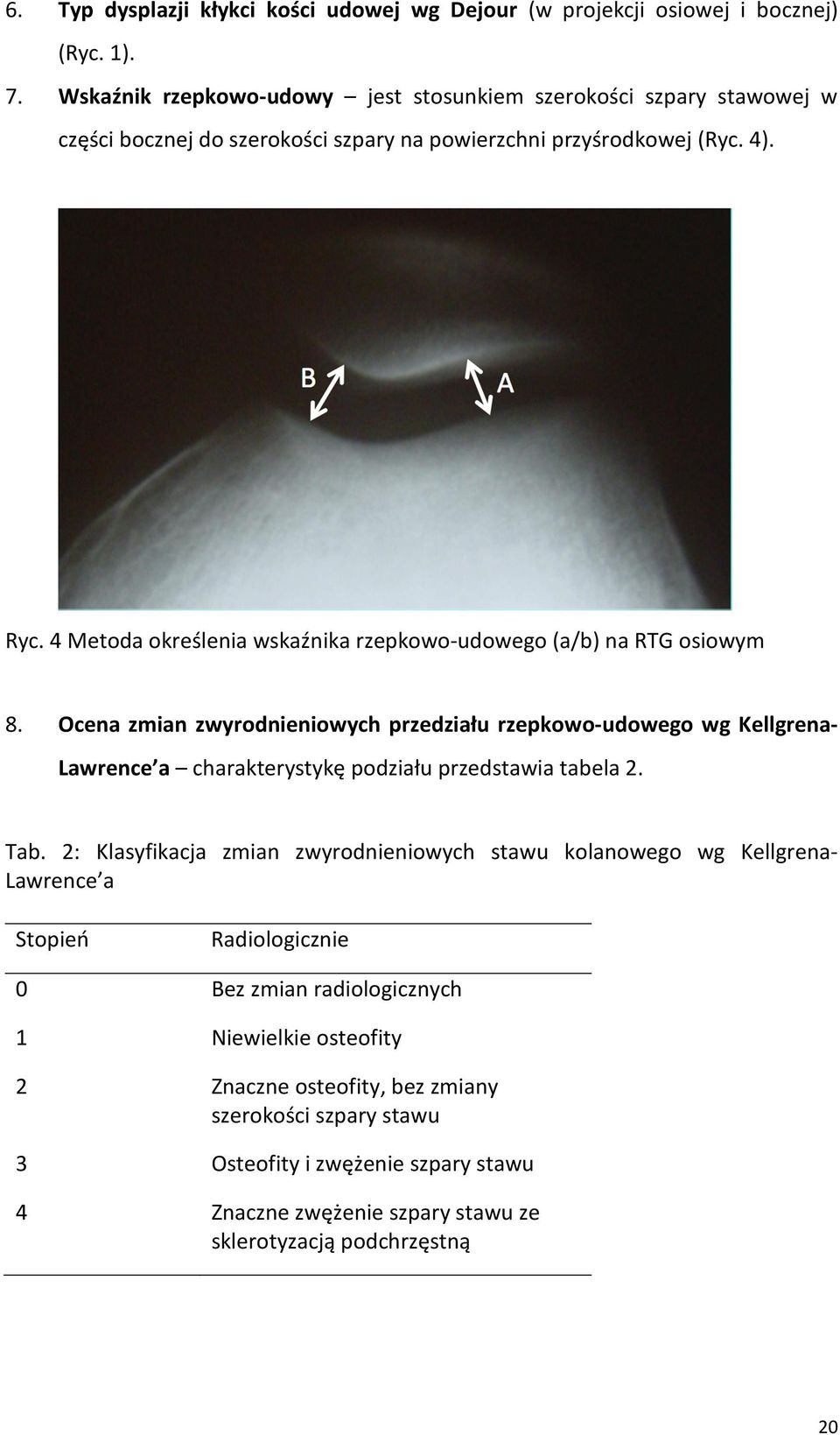 4 Metoda określenia wskaźnika rzepkowoudowego (a/b) na RTG osiowym 8.