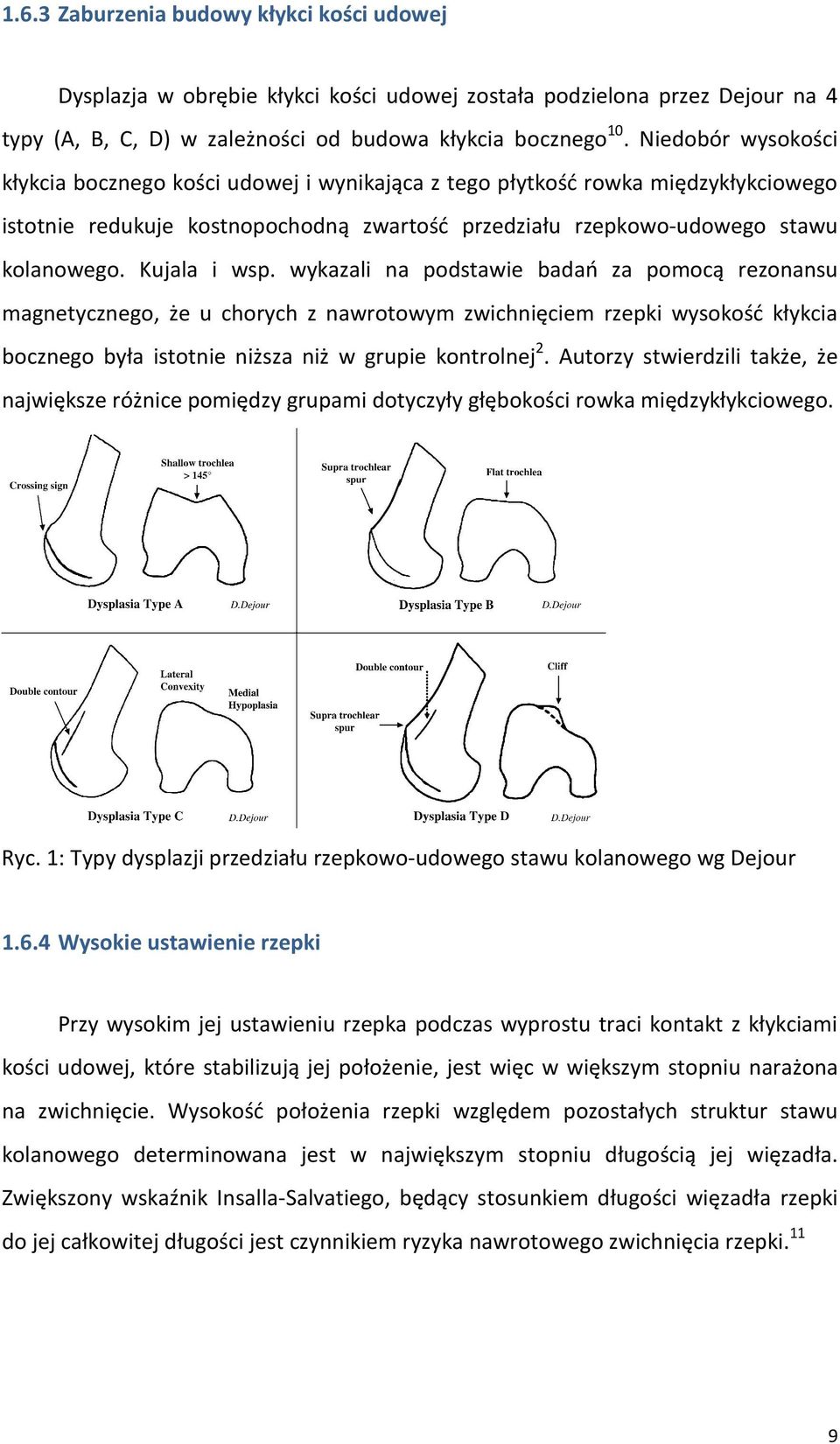Kujala i wsp. wykazali na podstawie badań za pomocą rezonansu magnetycznego, że u chorych z nawrotowym zwichnięciem rzepki wysokość kłykcia bocznego była istotnie niższa niż w grupie kontrolnej 2.