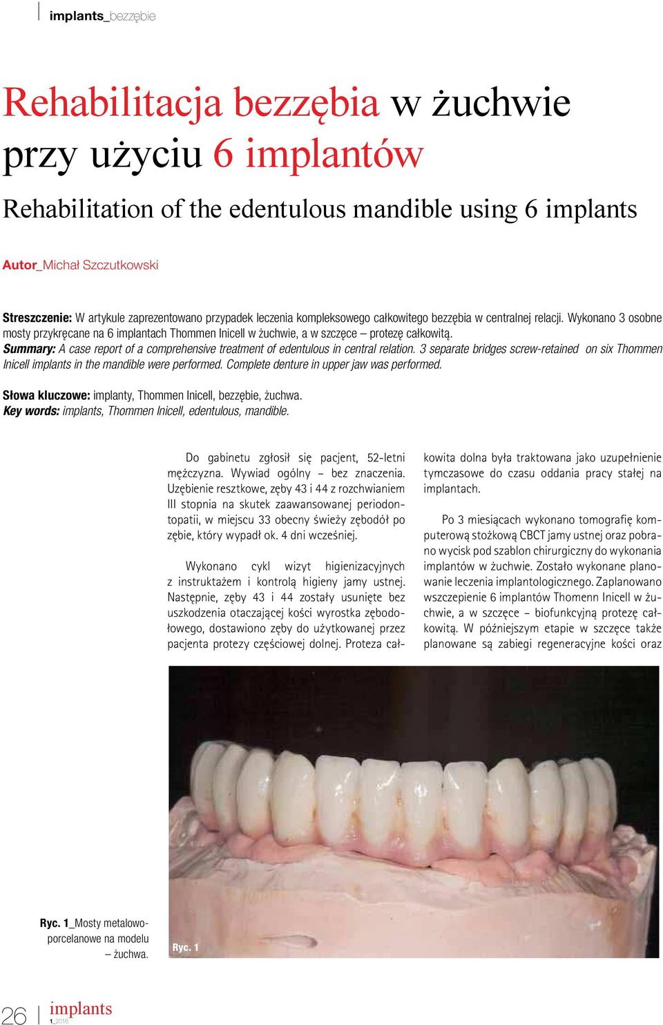Summary: A case report of a comprehensive treatment of edentulous in central relation. 3 separate bridges screw-retained on six Thommen Inicell in the mandible were performed.