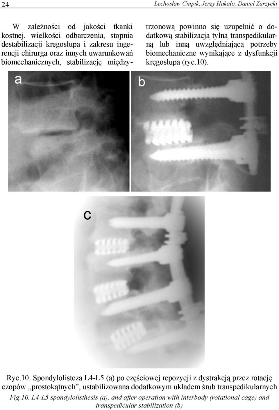 potrzeby biomechaniczne wynikające z dysfunkcji kręgosłupa (ryc.10)