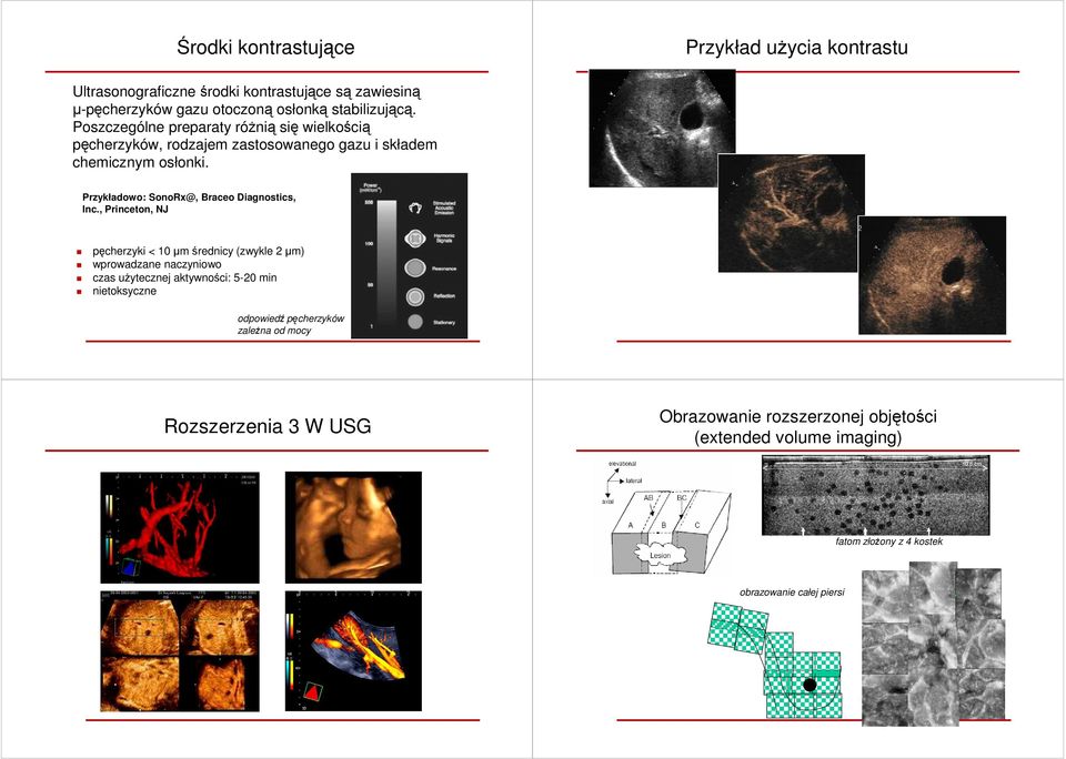 Przykładowo: SonoRx@, Braceo Diagnostics, Inc.