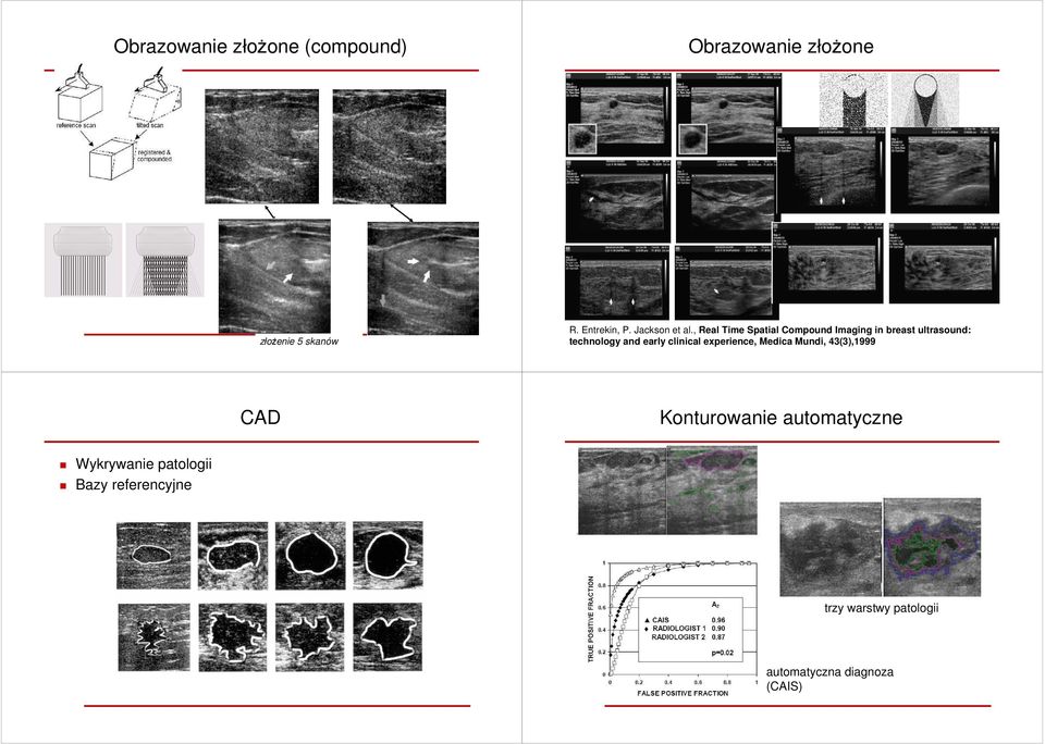 , Real Time Spatial Compound Imaging in breast ultrasound: technology and early
