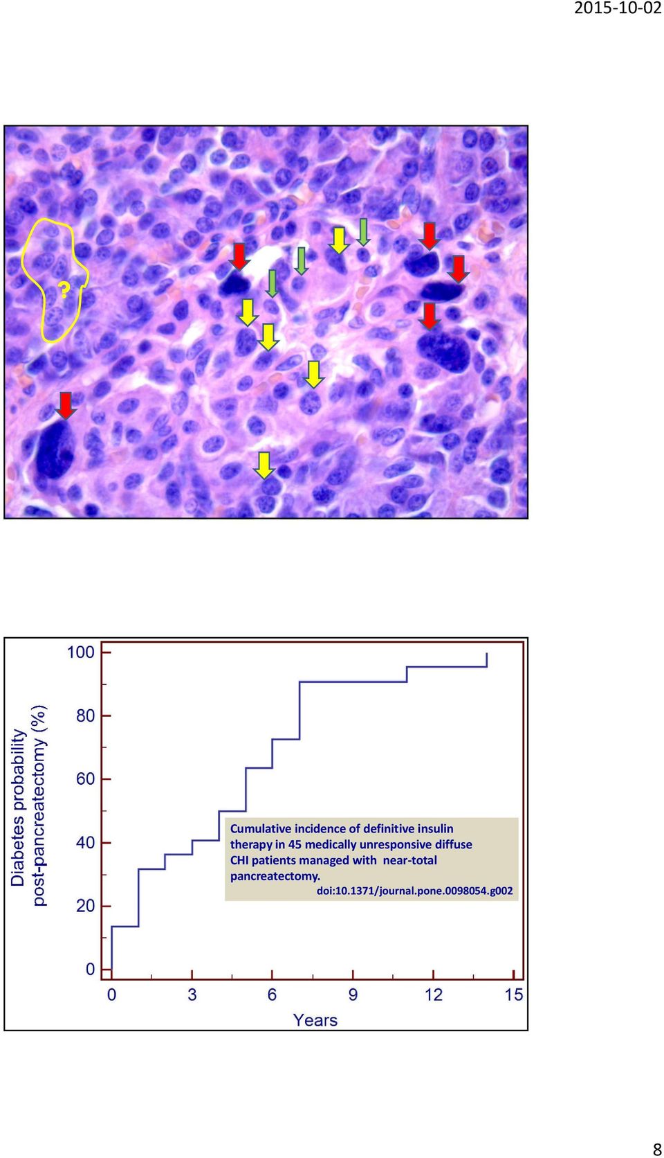 CHI patients managed with near-total