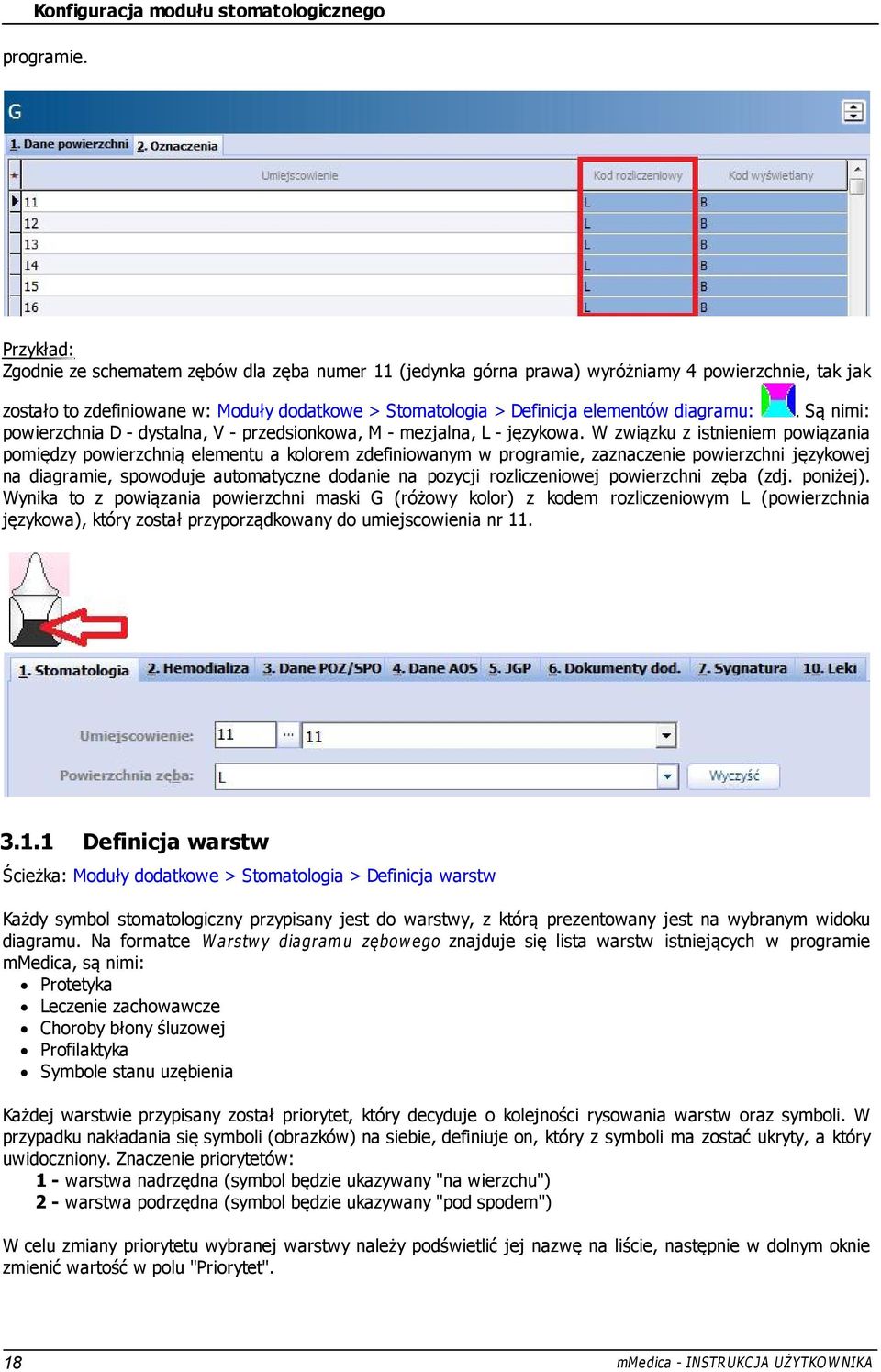 diagramu:. Są nimi: powierzchnia D - dystalna, V - przedsionkowa, M - mezjalna, L - językowa.
