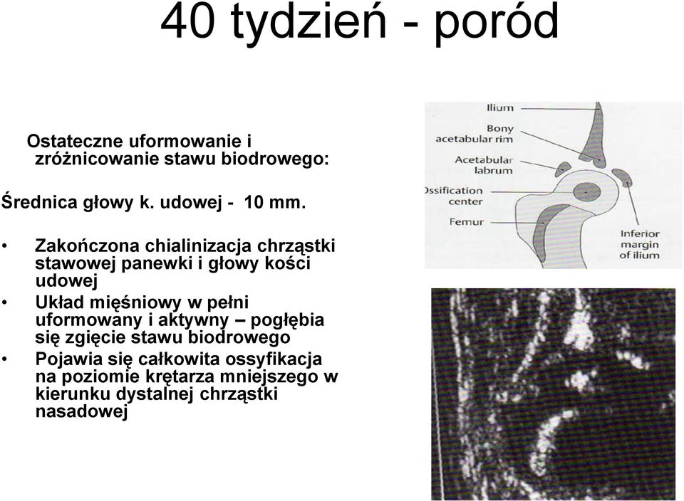 Zakończona chialinizacja chrząstki stawowej panewki i głowy kości udowej Układ mięśniowy w