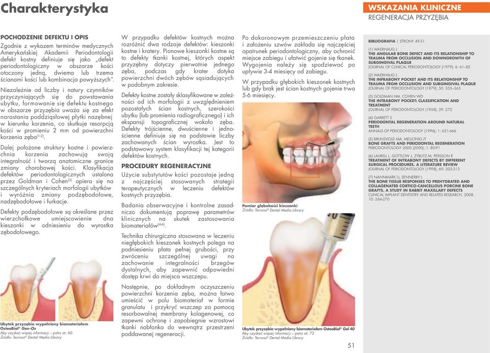 Niezależnie od liczby i natury czynników przyczyniających się do powstawania ubytku, formowanie się defektu kostnego w obszarze przyzębia uważa się za efekt narastania poddziąsłowej płytki nazębnej w