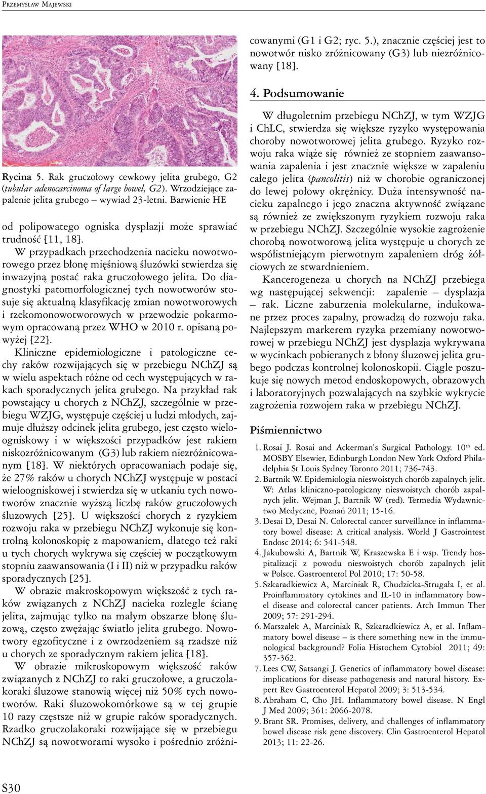 Do diagnostyki patomorfologicznej tych nowotworów stosuje się aktualną klasyfikację zmian nowotworowych i rzekomonowotworowych w przewodzie pokarmowym opracowaną przez WHO w 2010 r.