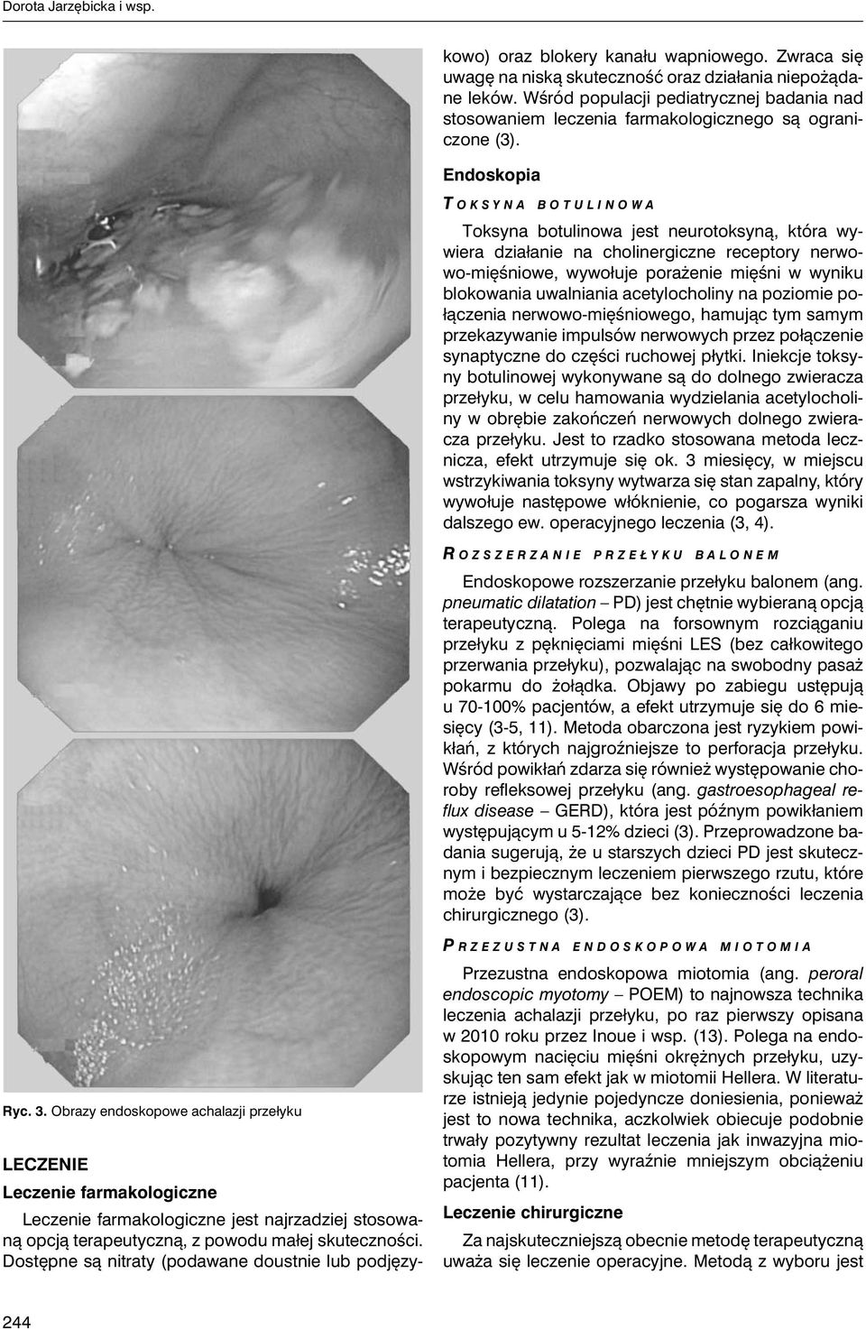 Wśród populacji pediatrycznej badania nad stosowaniem leczenia farmakologicznego są ograniczone (3).