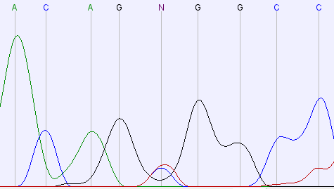 (a) Pacjentka z CVID heterozygota P251L (b) Pacjentka z CVID brak polimorfizmu Rysunek 39: Polimorfizm P251L u rodzeństwa z CVID.