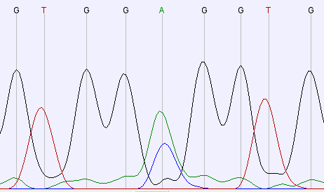 (a) Sekwencja prawidłowa (b) Mutacja C104R u chłopca z SIgAD (c) Mutacja C104R u chłopca z THI Rysunek 42: Mutacja C104R u dziecka z SIgAD