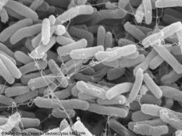 WPŁYW NANOCZĄSTEK SREBRA NA ROZWÓJ BAKTERII Hipoteza: Nanocząstki srebra o zróżnicowanych właściwościach Powierzchniowych powinny wykazywać odmienne właściwości biobójcze. Pałeczka okrężnicy (łac.