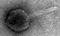 proteobakterii (Sinorhizobium, Paracoccus) Bakteriofagi γ