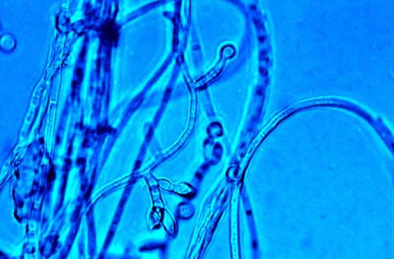 Za sprawców choroby uważa się grzyby z rodzaju Fusarium: F. acuminatum, F. culmorum, F. crookwellense, F.