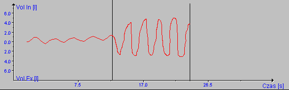 2.3 Badanie maksymalnej wentylacji dowolnej (MVV) Badanie MVV pozwala na wyznaczenie maksymalnej wentylacji dowolnej (MVV - Maximal Voluntary Ventilation).