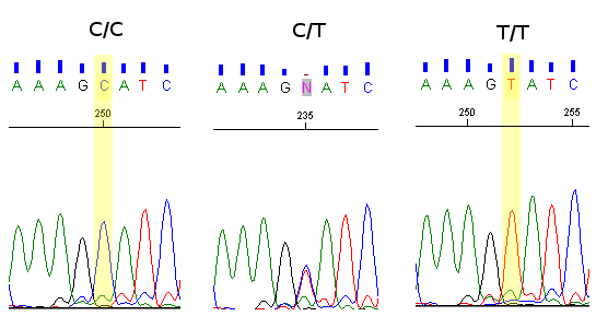 WYNIKI Rysunek 20: Fluorogramy przedstawiające polimorfizmy CYP2C19*2. Na rysunku pokazano homozygotę G/G (pacjent A2) i heterozygotę G/A (pacjent A33).