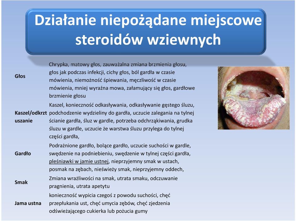 wydzieliny do gardła, uczucie zalegania na tylnej uszanie ścianie gardła, śluz w gardle, potrzeba odchrząkiwania, grudka śluzu w gardle, uczucie że warstwa śluzu przylega do tylnej części gardła,
