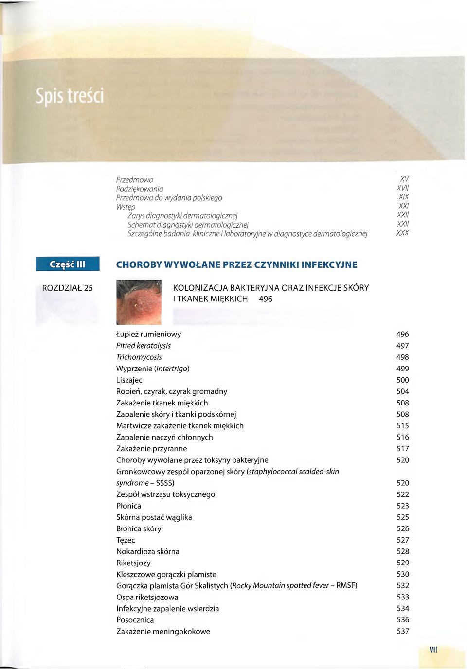 keratolysis Trichomycosis Wyprzenie (intertrigo) Liszajec Ropień, czyrak, czyrak gromadny Zakażenie tkanek miękkich Zapalenie skóry i tkanki podskórnej Martwicze zakażenie tkanek miękkich Zapalenie