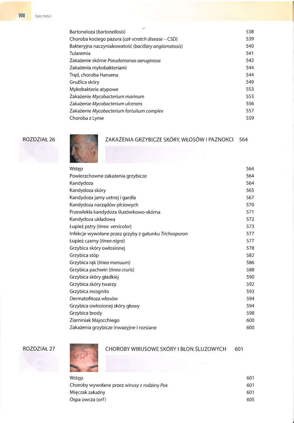 Zakażenie Mycobacterium fortuitum complex 557 Choroba z Lyme 559 RO ZD ZIAŁ 26 ZAKAŻEN IA GRZYBICZE SKÓRY, W ŁO S Ó W I PAZNOKCI 564 Wstęp 564 Powierzchowne zakażenia grzybicze 564 Kandydoza 564