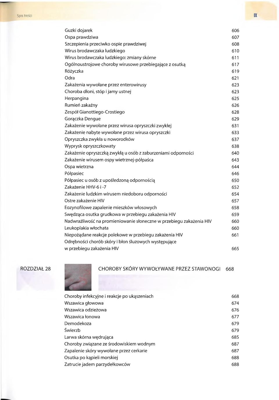 Gianottiego-Crostiego 628 Gorączka Dengue 629 Zakażenie wywołane przez wirusa opryszczki zwykłej 631 Zakażenie nabyte wywołane przez wirusa opryszczki 633 Opryszczka zwykła u noworodków 637 Wyprysk