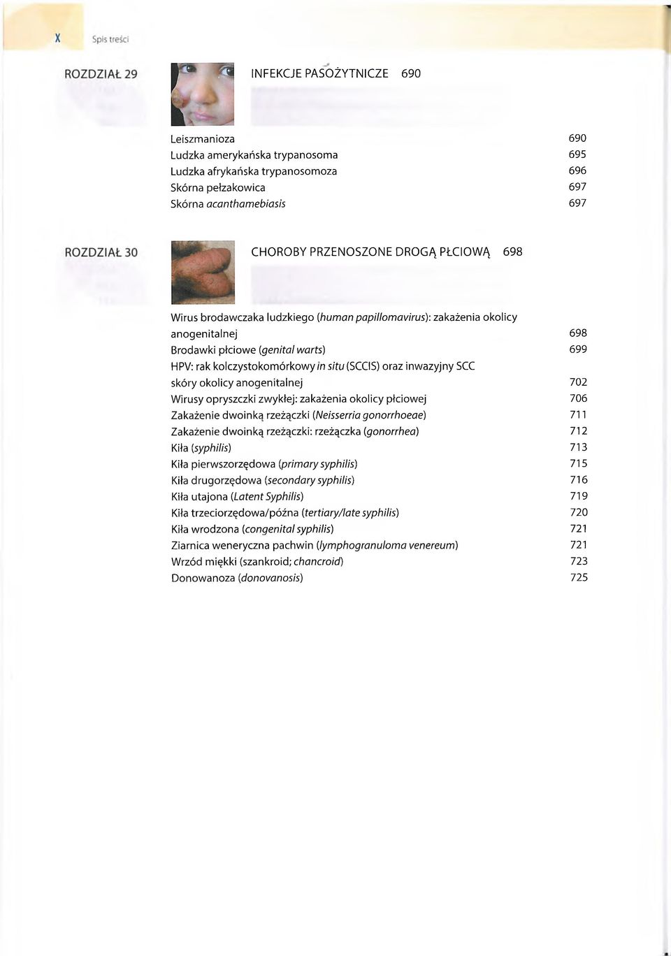 okolicy anogenitalnej Wirusy opryszczki zwykłej: zakażenia okolicy płciowej Zakażenie dwoinką rzeżączki {Neisserria gonorrhoeae) Zakażenie dwoinką rzeżączki: rzeżączka (gonorrhea) Kiła (syphilis)