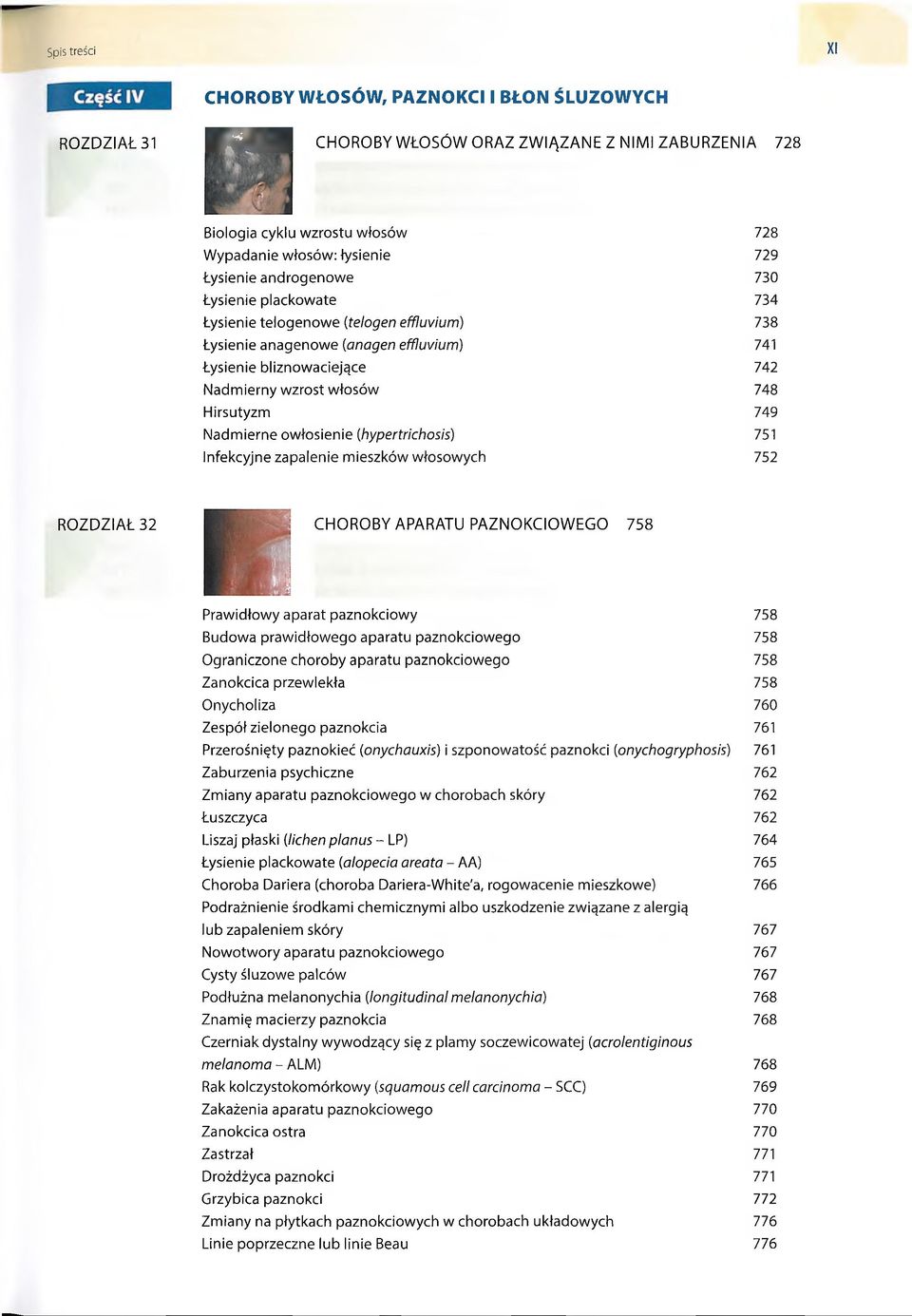 włosów 748 Hirsutyzm 749 Nadmierne owłosienie (hypertrichosis) 751 Infekcyjne zapalenie mieszków włosowych 752 ROZDZIAŁ 32 CHOROBY APARATU PAZN O KCIO W EGO 758 Prawidłowy aparat paznokciowy 758