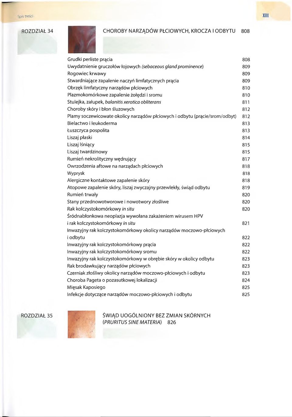 narządów płciowych i odbytu (prącie/srom/odbyt) Bielactwo i leukoderma Łuszczyca pospolita Liszaj płaski Liszaj lśniący Liszaj twardzinowy Rumień nekrolityczny wędrujący Owrzodzenia aftowe na
