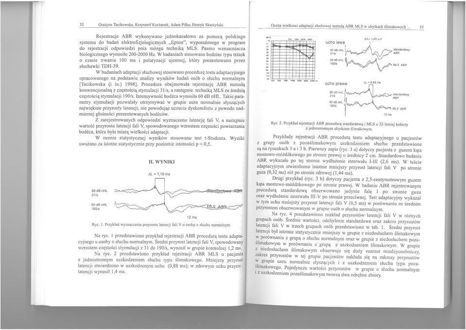 Pasmo wzmacniacza biologicznego wynosiło 200-2000 Hz. W badaniach stosowano bodziec typu trzask o czasie trwania 100 ms i polaryzacji ujemnej, który prezentowano przez słuchawki TDH-39.