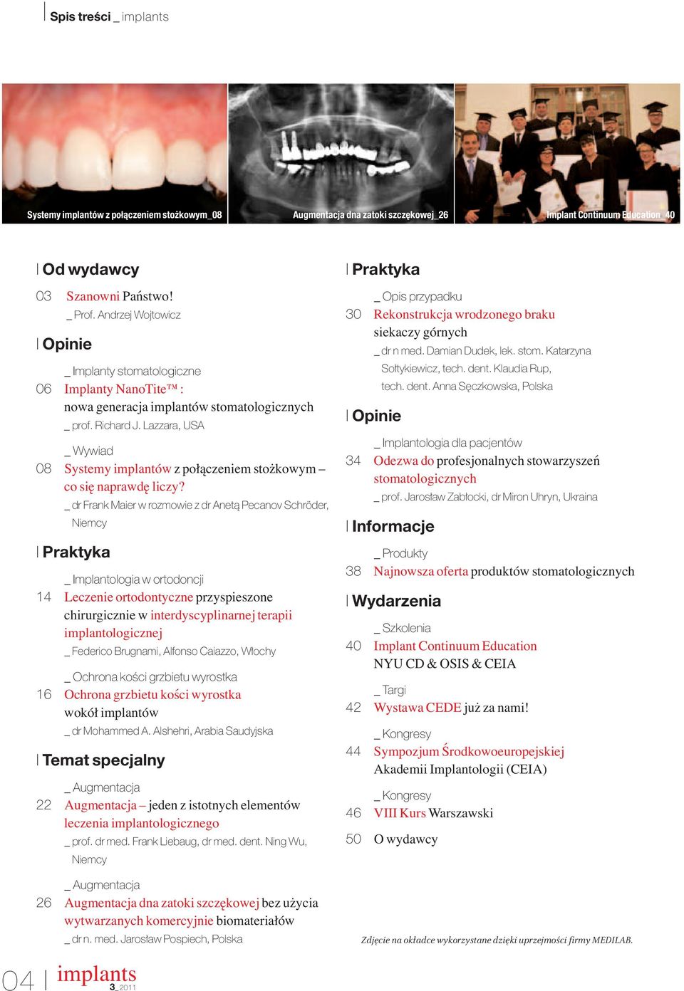 Lazzara, USA _ Wywiad 08 Systemy implantów z połączeniem stożkowym co się naprawdę liczy?