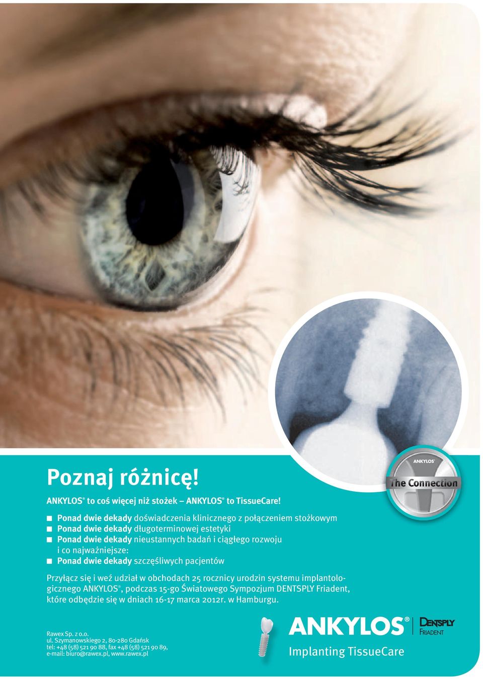 i co najważniejsze: Ponad dwie dekady szczęśliwych pacjentów Przyłącz się i weź udział w obchodach 25 rocznicy urodzin systemu implantologicznego ANKYLOS, podczas