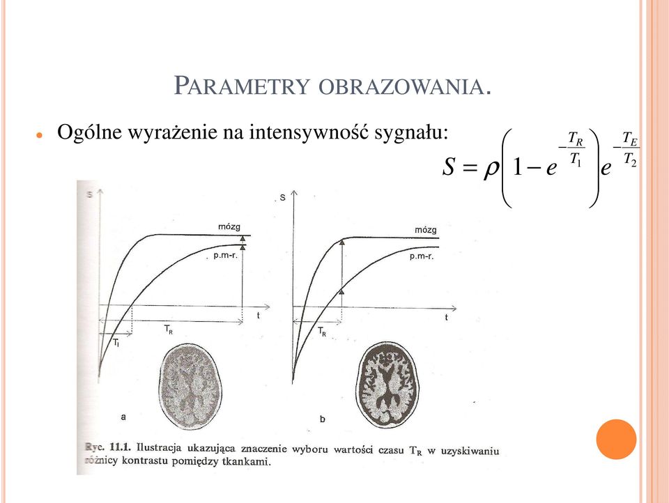 intensywność sygnału: